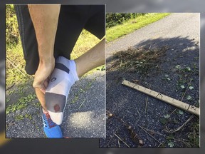 A Facebook user says he was injured on a bike path in Longueuil when he stepped on a board with nails.