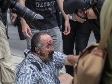 The far-right group La Meute and counter-protesters, organized by a group called Citizen Action Against Discrimination as well as the Ligue anti-fasciste Québec clashed in Quebec City, on Sunday, August 20, 2017. Eric Roy was confronted by protesters and eventually suffered a bruised skull.