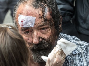 The far-right group La Meute and counter-protesters, organized by a group called Citizen Action Against Discrimination as well as the Ligue anti-fasciste Québec clashed in Quebec City, on Sunday, August 20, 2017. Eric Roy was confronted by protesters and eventually suffered a bruised skull.