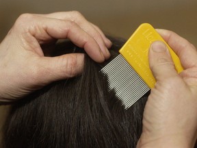 Combing out the lice is a popular alternative to using chemical insecticides.