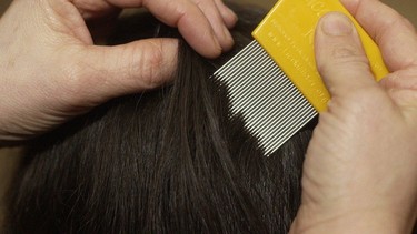 Combing out the lice is a popular alternative to using chemical insecticides.