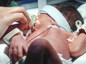 A nurse gives a premature baby its soother under a phototherapy lamp.