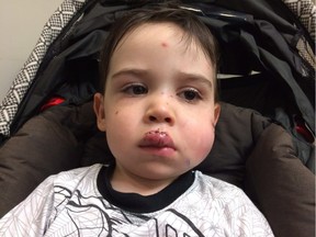 Two-year-old Hugo Giroux is shown in this undated handout photo. The mother of a western Quebec boy that was mauled by a pit bull-type dog says more needs to be done to ensure rules regarding dangerous dogs are being properly applied. Cleothilde Lefebvre-Bergeron says there's clearly a gap between the rules that exist and what happened to her two-year-son Hugo Giroux last Friday in the Aylmer's district of Gatineau.