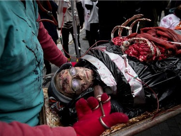 The 10-year-old son of a family of four take part in the annual Zombie Walk is wheeled down Peel St. in Montreal on Saturday, Oct. 27, 2018.