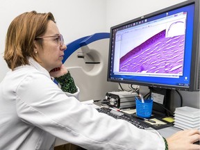 Scientist Ana Beatriz Toledo Dias, research sssociate at the RI-MUHC Ocular Pathology and Translational Research Laboratory, looks over a scan of a human cornea.