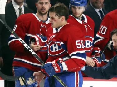 Noah Juulsen winces as he leaves the ice after taking a Washington Capitals shot to the face during first period at the Bell Centre on Monday, Nov. 19, 2018.