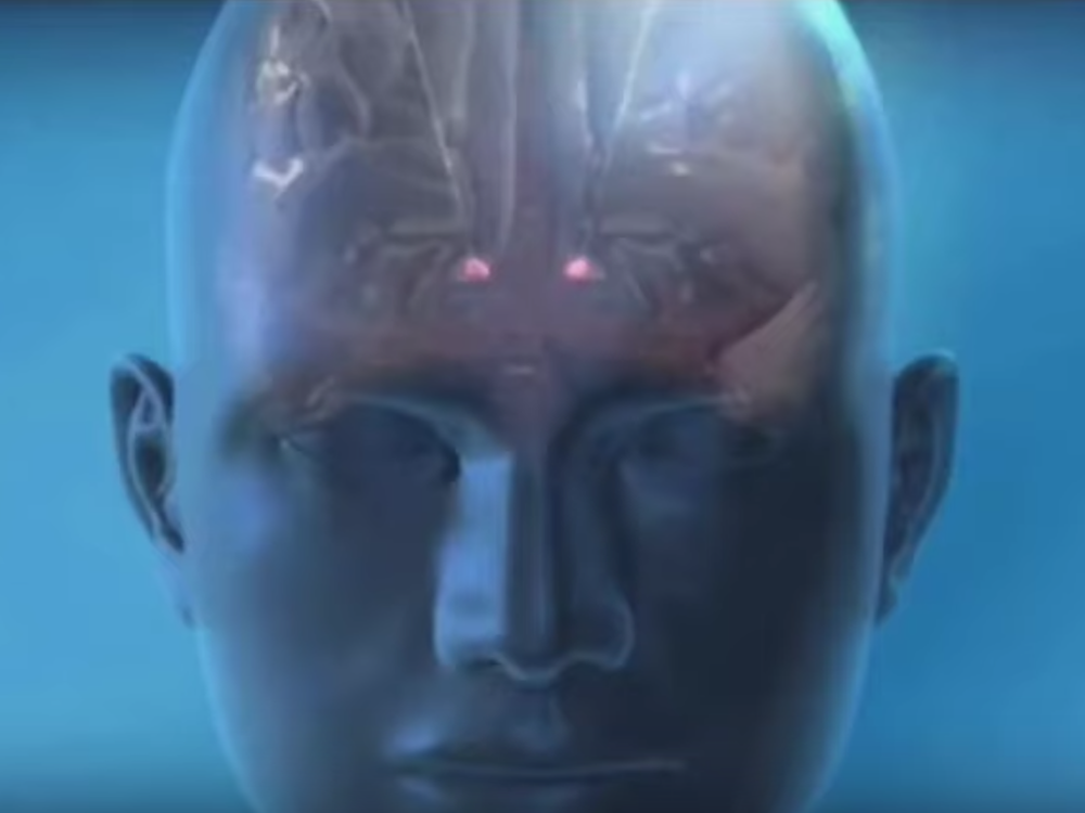 Watch Drilling holes in your skull to treat addiction Ottawa Citizen