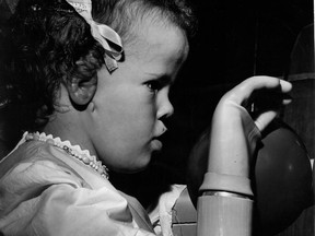Bernadette, 4,  a thalidomide victim, demonstrates the use of a motorized artificial arm. This photo was published on June 17, 1966.