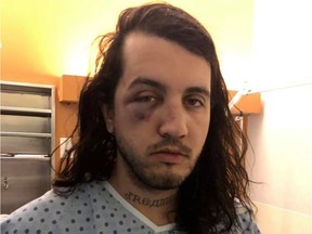 Montreal clothing designer Markantoine Lynch-Boisvert posted a photo of himself in a hospital gown and with a badly bruised face on Facebook Saturday morning.