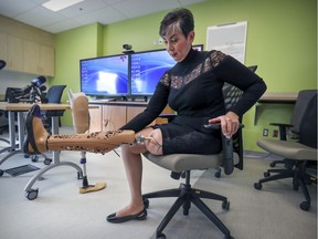 Michèle Forget shows her new prosthetic leg at the MUHC Glen Campus in Montreal Friday November 8, 2019.  Surgeons used an osseointegration technique to insert a metal rod into the bone of her stump to afix the prosthesis to.  The procedure is inspired by dental implant technology.