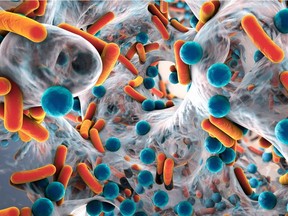 Biofilm of antibiotic resistant bacteria.