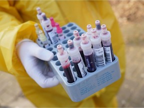 A medical volunteer holds vials of blood samples taken from visitors with symptoms to test them for COVID-19 infection on March 27, 2020 in Berlin, Germany.