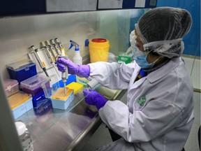 This photo taken on March 17, 2020 shows a laboratory technician working on testing samples at a laboratory in Changzhou in China's eastern Jiangsu province.