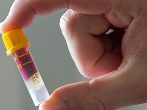 A blood sample ready to be posted back to the Lab is pictured in a micro sampling collection tube, as a man uses an IgG Antibody Test Kit which identifies Immunoglobulin G antibodies related to SARS-CoV-2, the virus that causes COVID-19, in London on Thursday, May 28, 2020, during the COVID-19 pandemic.