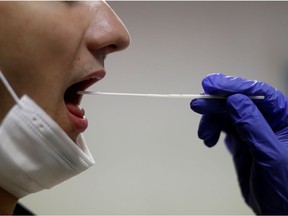 A firefighter from the Marins-Pompiers of Marseille (Marseille Naval Fire Battalion) takes a saliva sample from a collegue who is being tested for the coronavirus disease (COVID-19) at their fire station in Marseille, France, September 22, 2020.  REUTERS/Eric Gaillard
