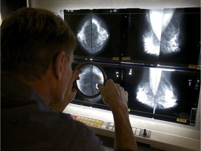 The Canadian Association of Radiologists and the CSBI recommend women age 40 and older have a mammogram each year.