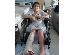 Conrad broke his femur, ankle, and tibia in sliding down a hill in the Laurentians in March 2020 when his toboggan hit a tree.