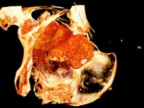 Scans revealed the mummy was a woman in her 20s who was pregnant when she died. Pictured is an abdominal scan of her remains.