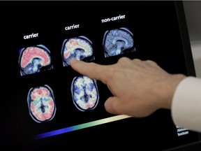 A researcher into Alzheimer's disease looks at PET brain scans. Brain health is a popular concern, but Joe Schwarcz is skeptical about the Youthful Brain supplement being marketed by a naturopath.