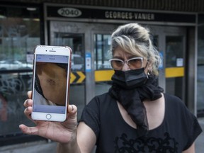 Dora Quintero Sanabria, 53, shows a photo of bruising on her hip area. She plans to file complaints with the Montreal police ethics commission and the Quebec Human Rights Commission after she says she was violently stopped and detained at the exit of the Georges-Vanier métro station on Oct. 5.