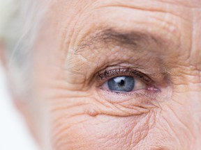 On estime qu’en 2019, plus de 2,5 millions de Canadiens étaient atteints de DMLA, la principale cause de perte de vision chez les personnes de plus de 50 ans. ISTOCK