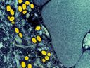 Eine kolorierte Transmissionselektronenmikrographie von Affenpockenpartikeln (gelb), die in einer infizierten Zelle (blau) gefunden wurden, ist auf einem Handout-Foto zu sehen, das in der NIAID Integrated Research Facility (IRF) in Fort Detrick, Maryland, aufgenommen wurde. 