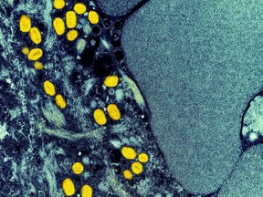 A colourized transmission electron micrograph of monkeypox particles (yellow) found within an infected cell (blue), is shown in a handout photo captured at the NIAID Integrated Research Facility (IRF) in Fort Detrick, Maryland.
