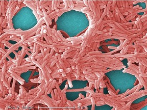 Colorized scanning electron micrograph (SEM) with moderately-high magnification of 5000X, depicting a large grouping of Gram-negative Legionella pneumophila bacteria which causes Legionnaires' disease.