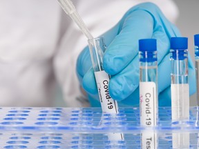 Quebec limited PCR testing for COVID-19 to priority groups in early January, a decision that many experts argued against.