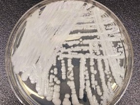 This undated photo made available by the Centers for Disease Control and Prevention shows a strain of Candida auris cultured in a petri dish at a CDC laboratory.