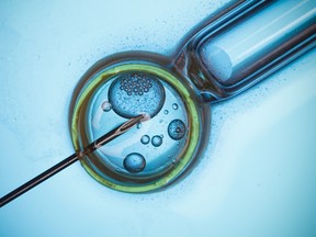 Radar Healthcare researchers examined legislation in 35 developed countries, including the ages at which people can access IVF treatment, mammogram screening; transgender hormone treatment therapy; abortions and birth control.