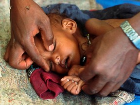 A nurse closes the eyes of a young child who had just died in a refugee camp in Derwernache, Ethiopia in December 1991. This photo was nominated for a National Newspaper Award.