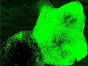 Clumps of cells in a lab dish, with the neurons shown in green.