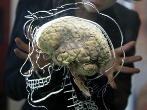 A human brain surrounded by a drawing of a human head is seen in this photo.