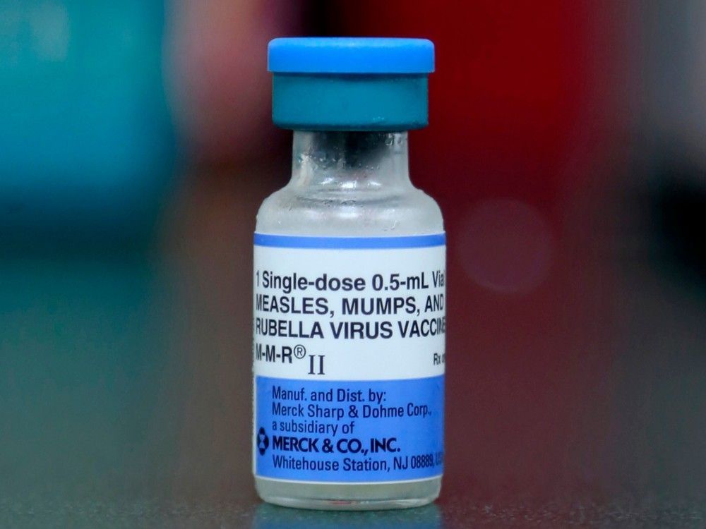 Passengers may have been exposed to measles on Montreal-Fredericton ...