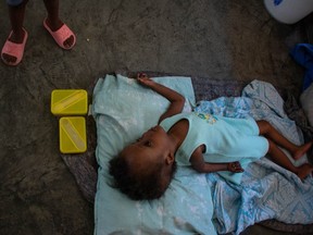 A child suffering from macrocephaly lies on the floor in a school that has become a shelter for displaced people amid the gang-related violence that has wracked the country, in Port-au-Prince on April 22, 2024.
