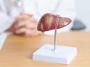 Doctor with human liver anatomy model