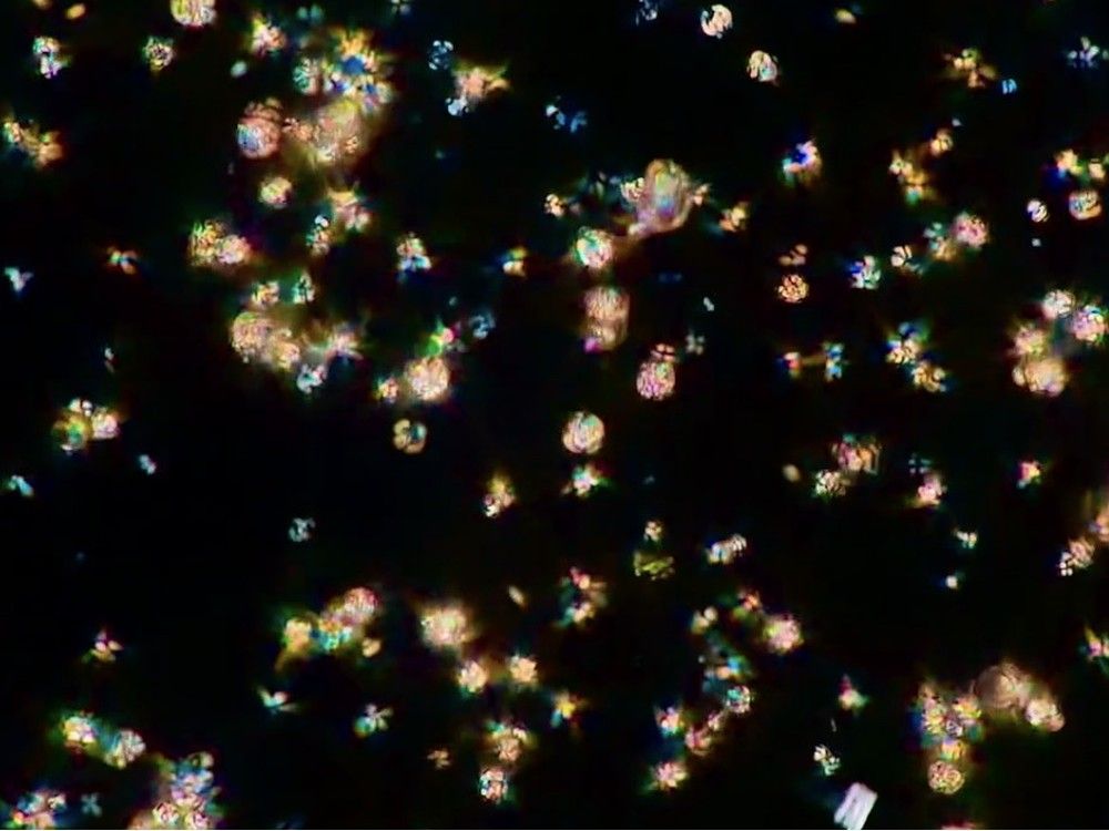  a screenshot from chloé savard’s microscopic video of bird poop. photo by chloé savard