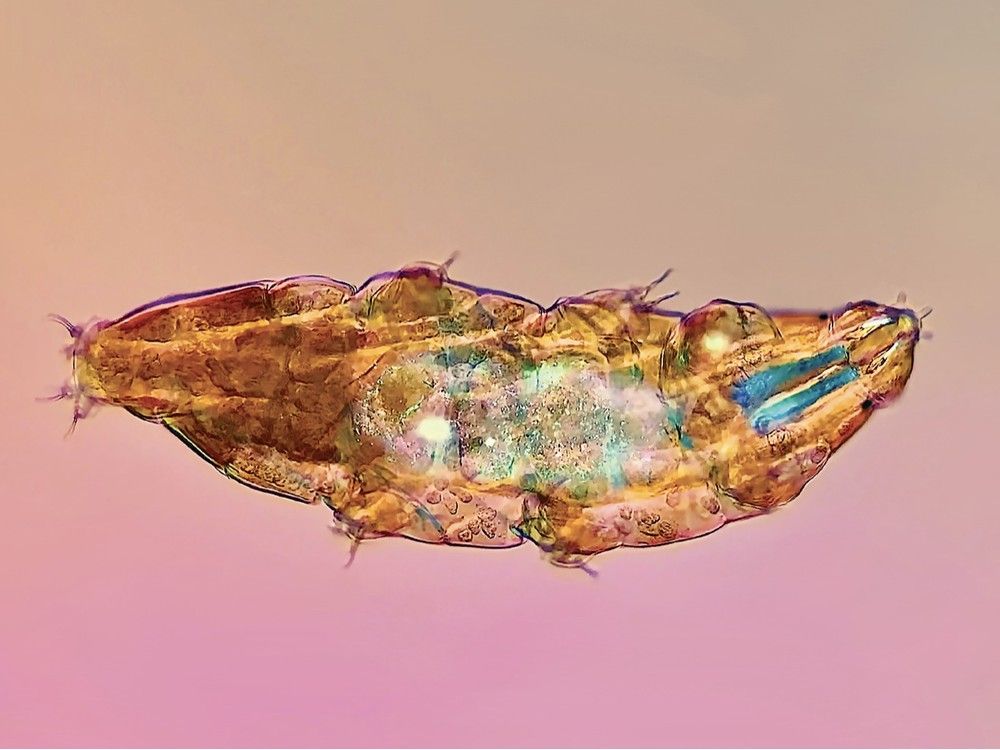  a microscopic photo of a tardigrade, also known as a water bear. photo by chloé savard