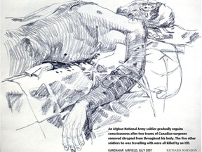 Afghan casualty sketch