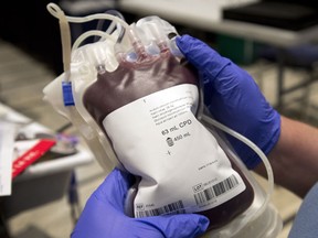 A bag of blood is shown at a clinic Thursday, November 29, 2012 in Montreal. Hema Quebec, the provincial blood agency, said that as much as 70 per cent of the blood inventory stockpiled for transfusion had been placed temporarily aside, while tests are conducted. (Ryan Remiorz / The Canadian Press)