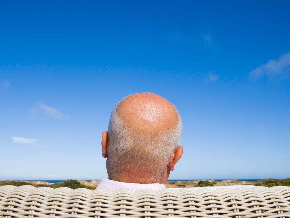 Going bald before age 50 linked to increased risk of heart disease