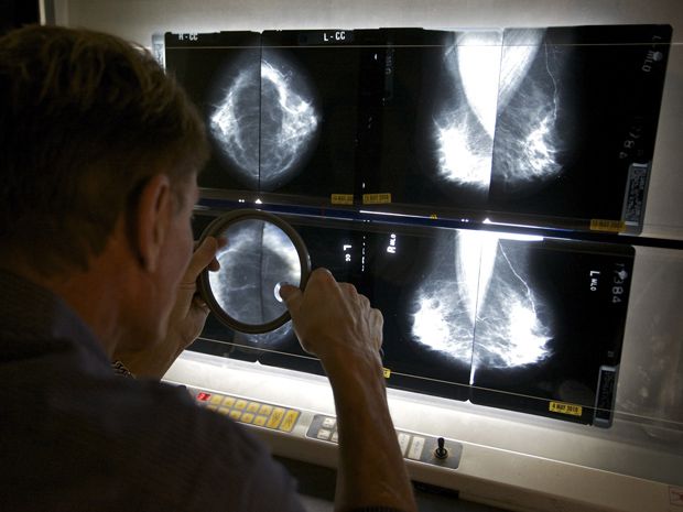 Breast Imaging – Mammography  Ontario Association of Radiologists