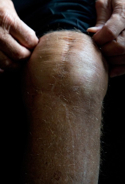 Bobby Orr Knee Injury 