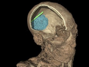 This undated handout image provided by The British Museum on Wednesday, April 9, 2014  shows the computer generated CT scan of the skull of the mummy of an adult man, name unknown. The scan shows the remains of the brain, coloured in blue, and evidence of a tool that was left in the skull as a mistake during the mummification process, in green. Scientists at the museum have used CT scans and sophisticated imaging software to go beneath the bandages, revealing skin, bones, preserved internal organs ó and in one case a brain-scooping rod left inside a skull by embalmers. The findings go on display next month in an exhibition that sets eight of the museum's mummies alongside detailed three-dimensional images of their insides and 3-D printed replicas of some of the items buried with them. (AP Photo/The British Museum) NO ARCHIVE