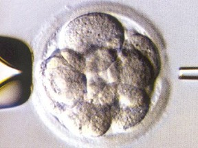 Under a microscope, a 3-day-old,  8-cell embryo created through in vitro fertilization is held in place with a pipette (left).