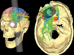 Image courtesy Van Horn JD, Irimia A, Torgerson CM, Chambers MC, Kikinis R, et al.