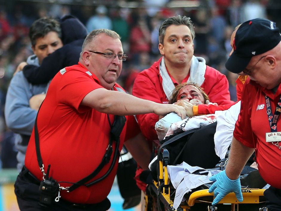 MLB Fan Hit by Foul Ball 