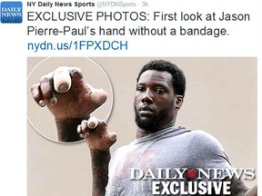 Picture of Giants defensive end Jason Pierre-Paul’s injured hand were published by the New York Daily News on Thursday.