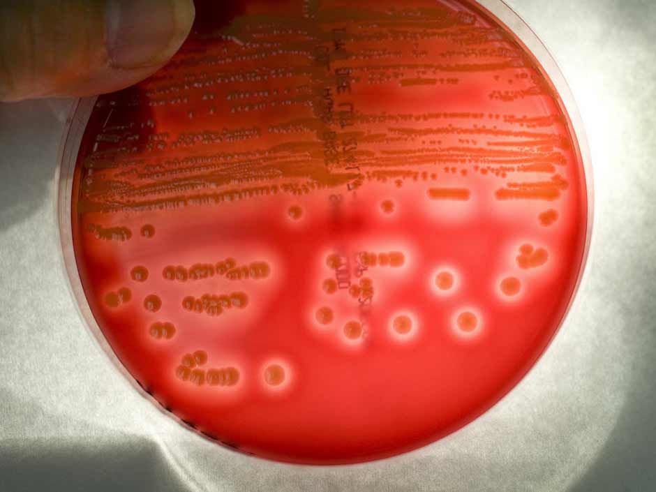 Superbugs cause 1 in 7 infections caught in hospitals: CDC | National Post